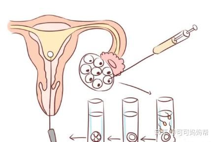 李雪梅
